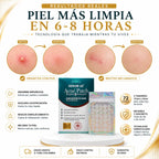 Serum 10 - Parches para el Acné